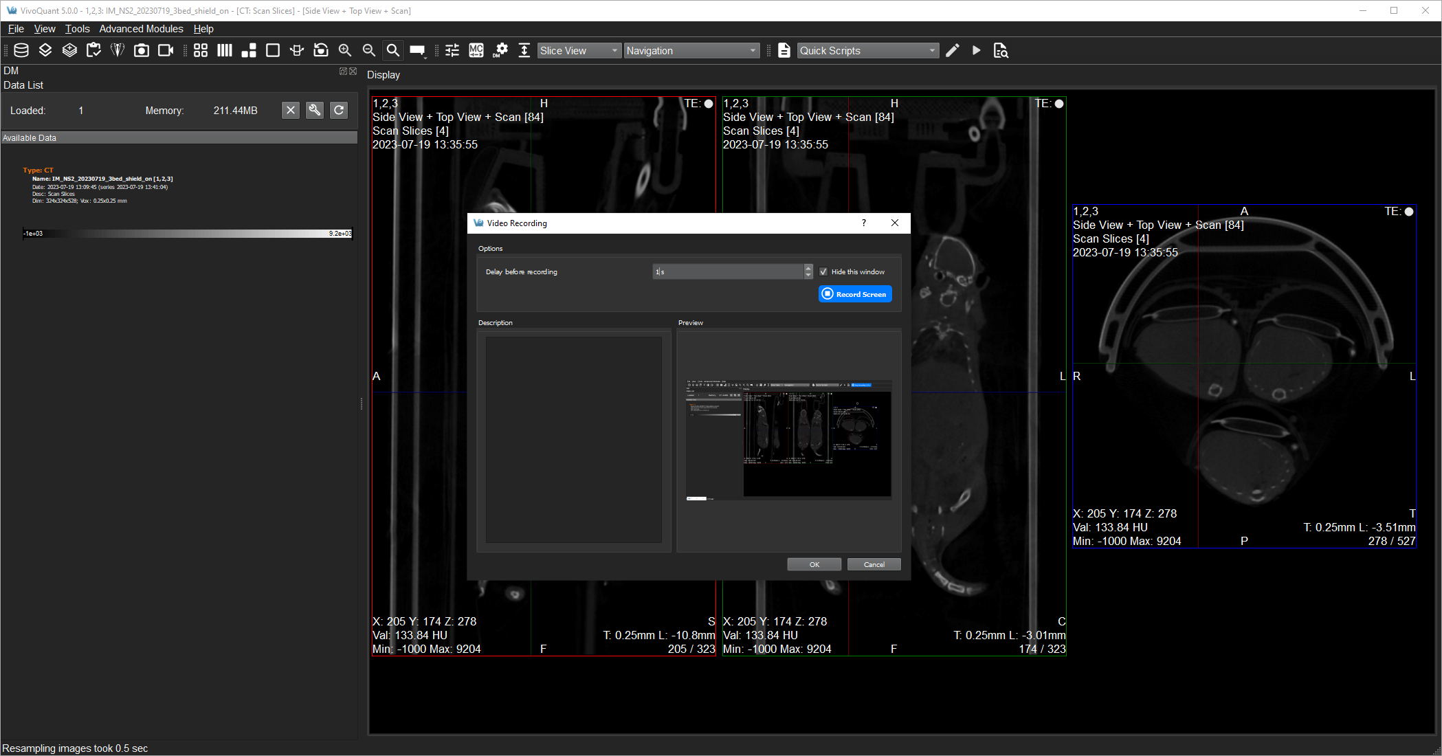 Image of VivoQuant UI: Crash Report Video Recording Option