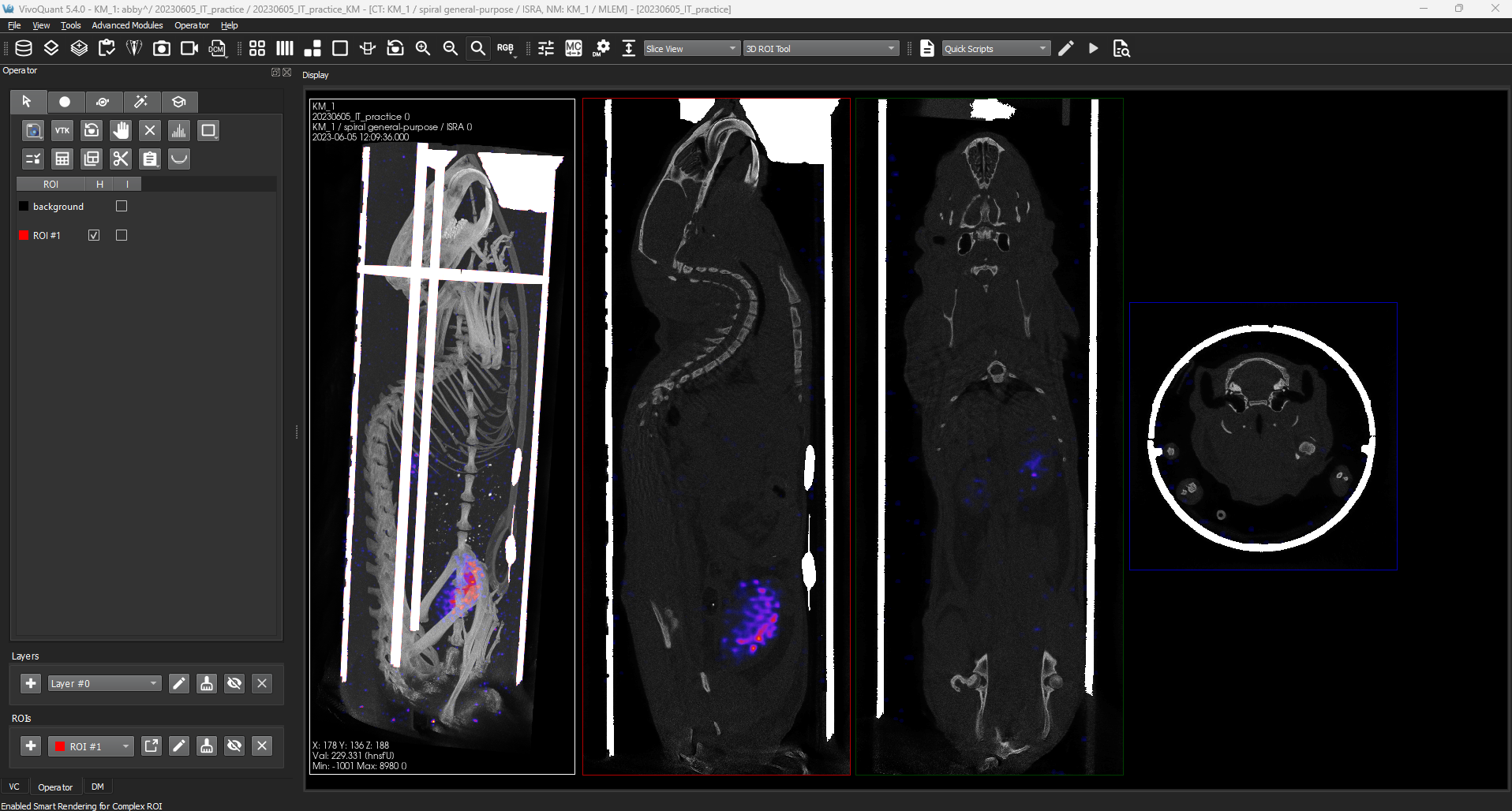 Image of VivoQuant UI: Data Cutting Result